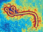 Ebola - Bild: Pasieka/Science Photo Library