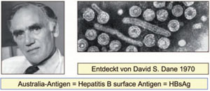 Abb. 3: David Dane und die von ihm im Blut von Hepatitis-Patienten entdeckten, 42-45 nm großen, doppelschaligen Viruspartikel mit Australia-Antigen auf der Oberfläche.