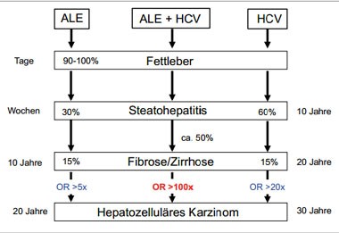 Abbildung 3: Natür-licher Verlauf der alko-hol- und HCV-bedingten  Lebererkrankung als  Monoerkrankung  oder in Kombination.  Besonders drastisch  wird das HCC-Risiko  bei HCV-Infizierten  durch zusätzlichen ris-kanten Alkoholkonsum  gesteigert.