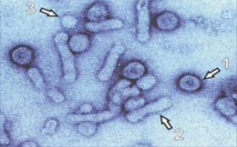 Abb. 1: HBsAg elektronenmikroskopisch: Virione 42 nm (1), Filamente 22nm (2), Sphärische Partikel (3) 