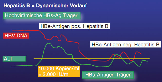 Abb. 3: Natürlicher Verlauf der chronischen Hepatitis B