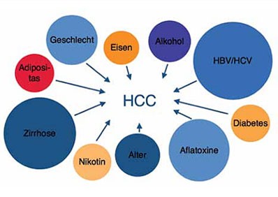 Abb. 1: Risikofaktoren für die Entwicklung eines HCCs