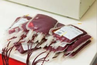 Abbildung 3: Alle Blutkonserven werden in  Deutschland auf HBsAg  und Anti-HBc, meist auch  auf HBV DNA, untersucht.