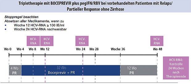 Abbildung 2: Partielle Response oder Relapse in der Vortherapie, keine Zirrhose