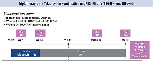 Abbildung 5: Partielle Response und Null-Response in der Vortherapie, alle Patienten mit Zirrhose