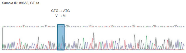 Abbildung 2: Das Chromatogramm zeigt einen Ausschnitt aus der NS3 Protease. Blau markiert ist das mutierte Codon ATG, das zum Aminosäureaustausch  V → M führt. 