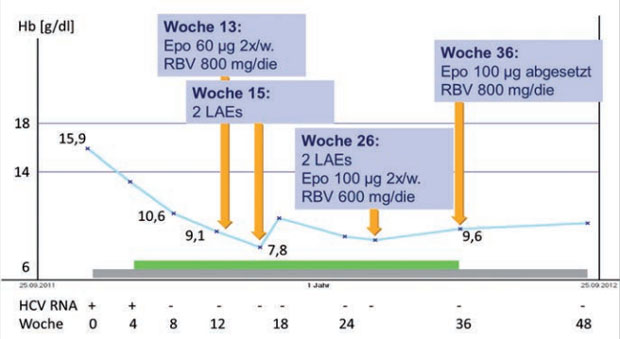 Abbildung 1: Verlauf des Hämoglobins unter Triple-Therapie mit Boceprevir. Grauer Balken: Therapie mit pegyliertem Interferon und Ribavirin. Grüner Balken: Phase der Triple-Therapie mit Boceprevir.