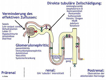 Abb. 4 Ursachen eines Nierenversagens schematisch