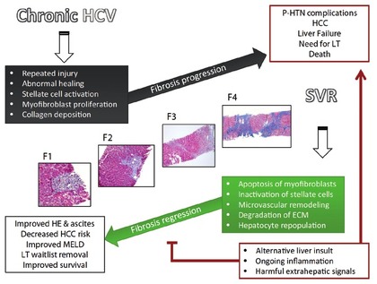 Abbildung 2: Fibroseprogression und Regression bei chronischer Hepatitis C. Aus Gonzalez HC, Duarte-Royo A. Virologic cure of Hepatitis C: Impact on Hepatic Fibrosis and Patient outcomes. Curr Gastroenterol Rep 2016;18:32